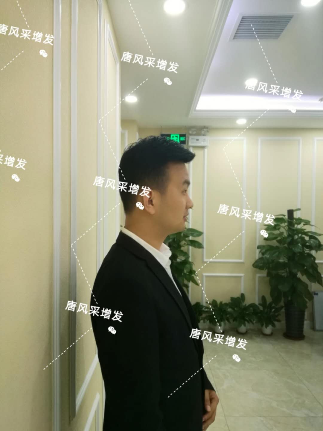輸了頭發(fā)不能輸氣質，看帥哥的逆襲之路！