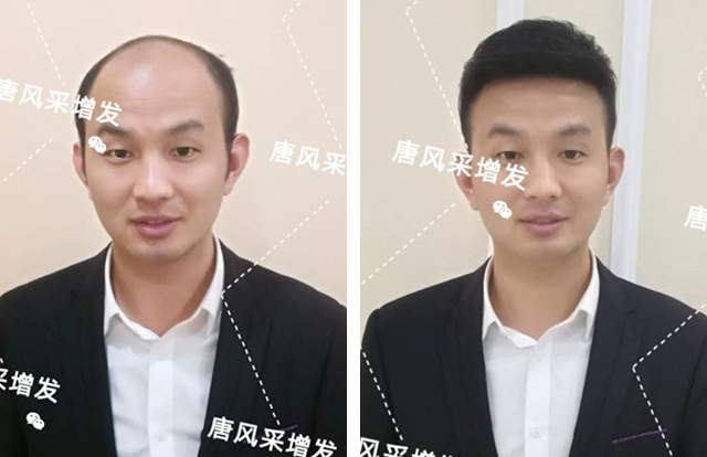輸了頭發(fā)不能輸氣質，看帥哥的逆襲之路！