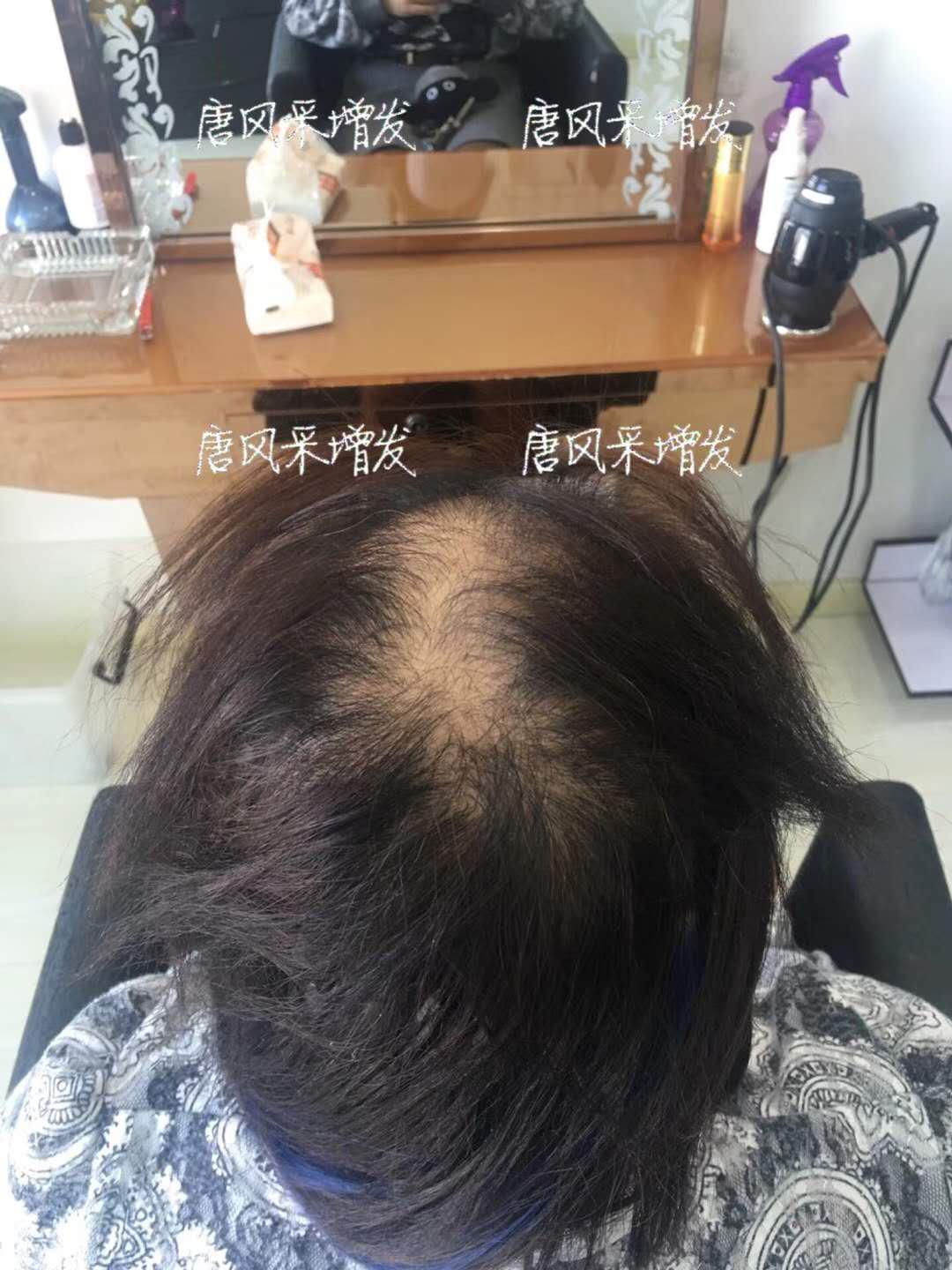 生發(fā)了這么久，但凡有效果的也該有些跡象了