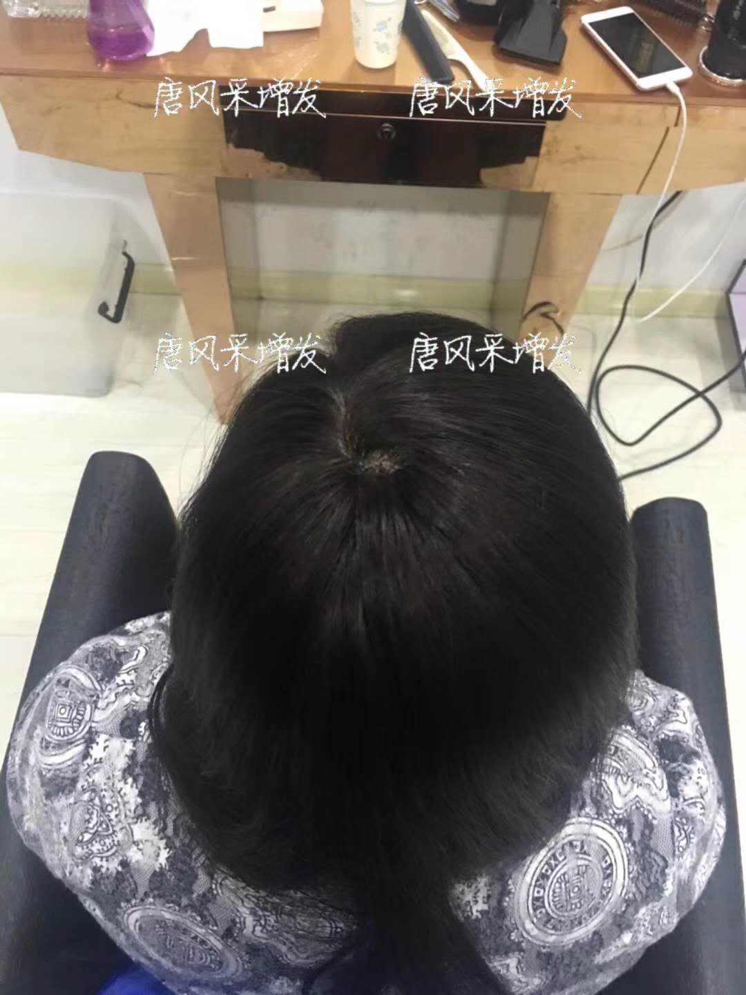 生發(fā)了這么久，但凡有效果的也該有些跡象了