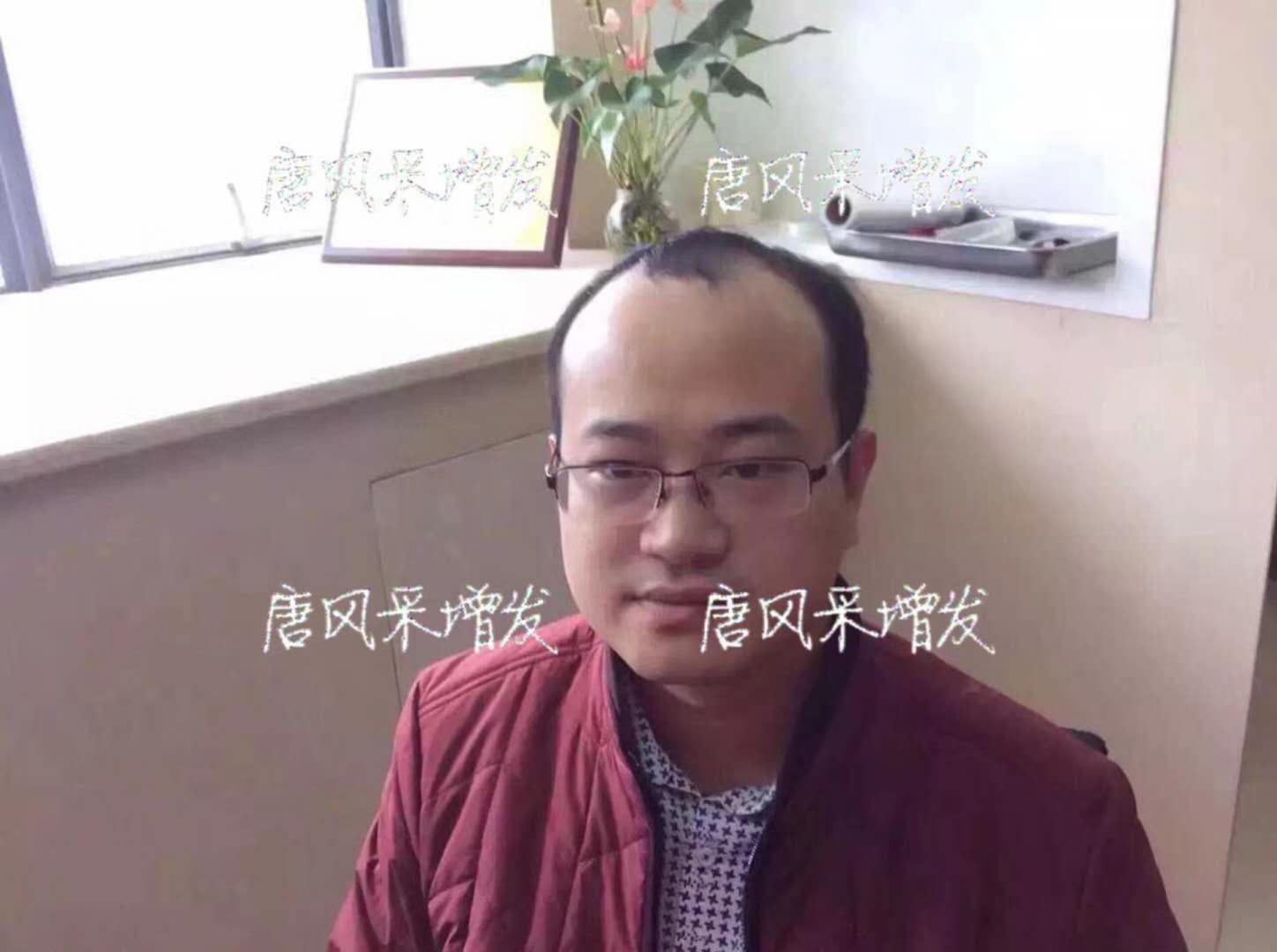  生發(fā)了這么久，但凡有效果的也該有些跡象了