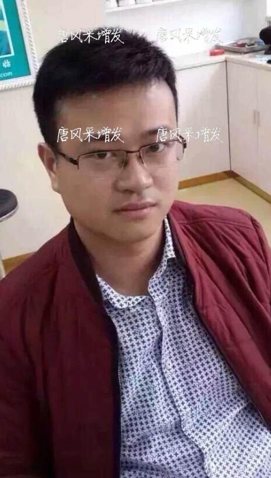  生發(fā)了這么久，但凡有效果的也該有些跡象了