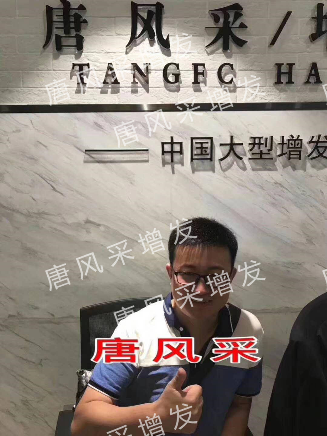 貧窮限制了想象，禿頂限制了造型？