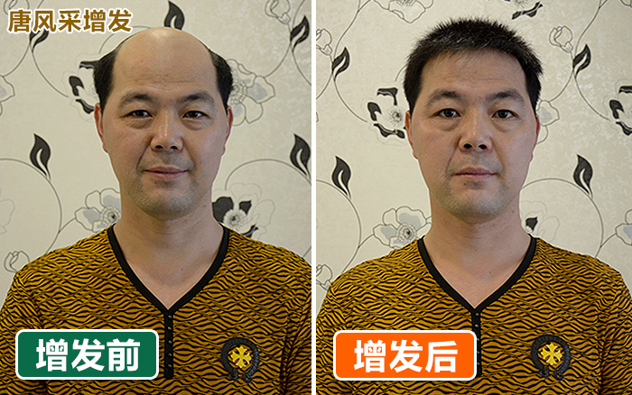 增發(fā)，大家說(shuō)好才是真的好！