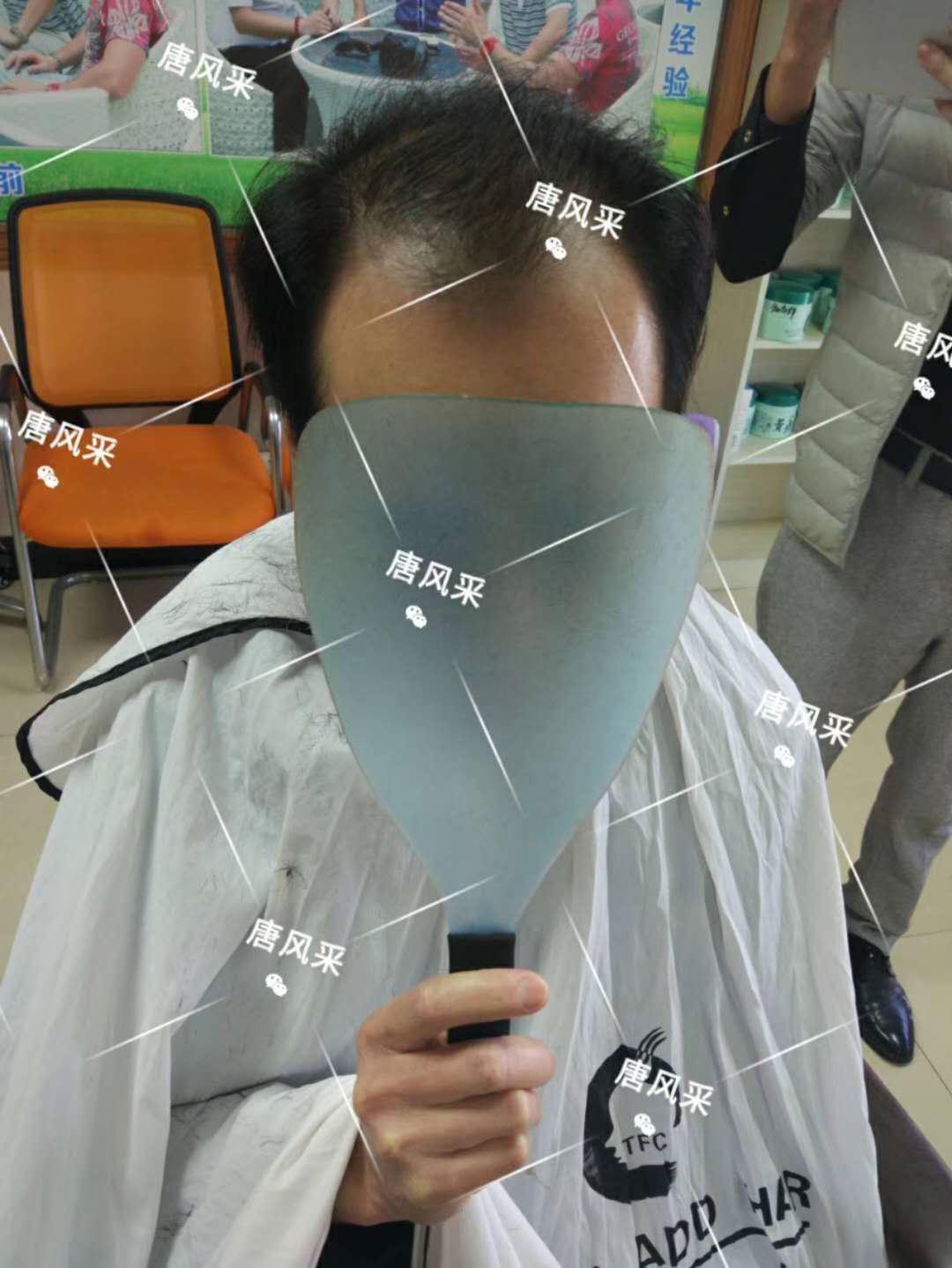 脫發(fā)謝頂壓力大，增發(fā)補(bǔ)發(fā)一身輕！
