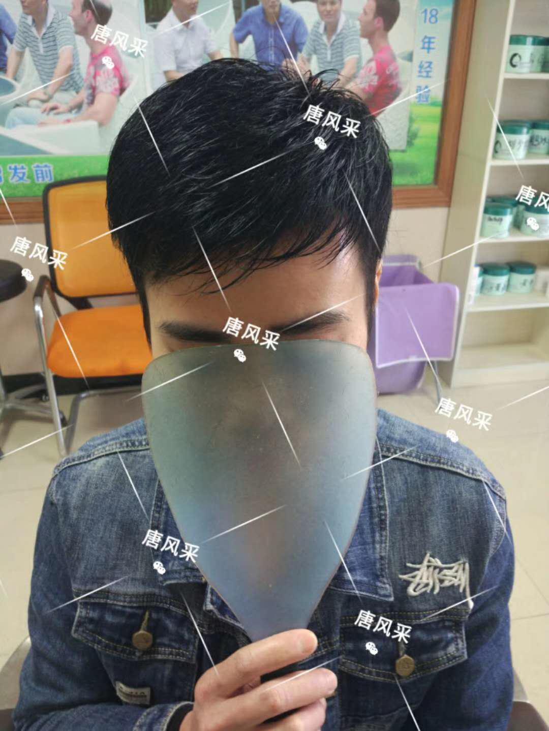 脫發(fā)謝頂壓力大，增發(fā)補(bǔ)發(fā)一身輕！