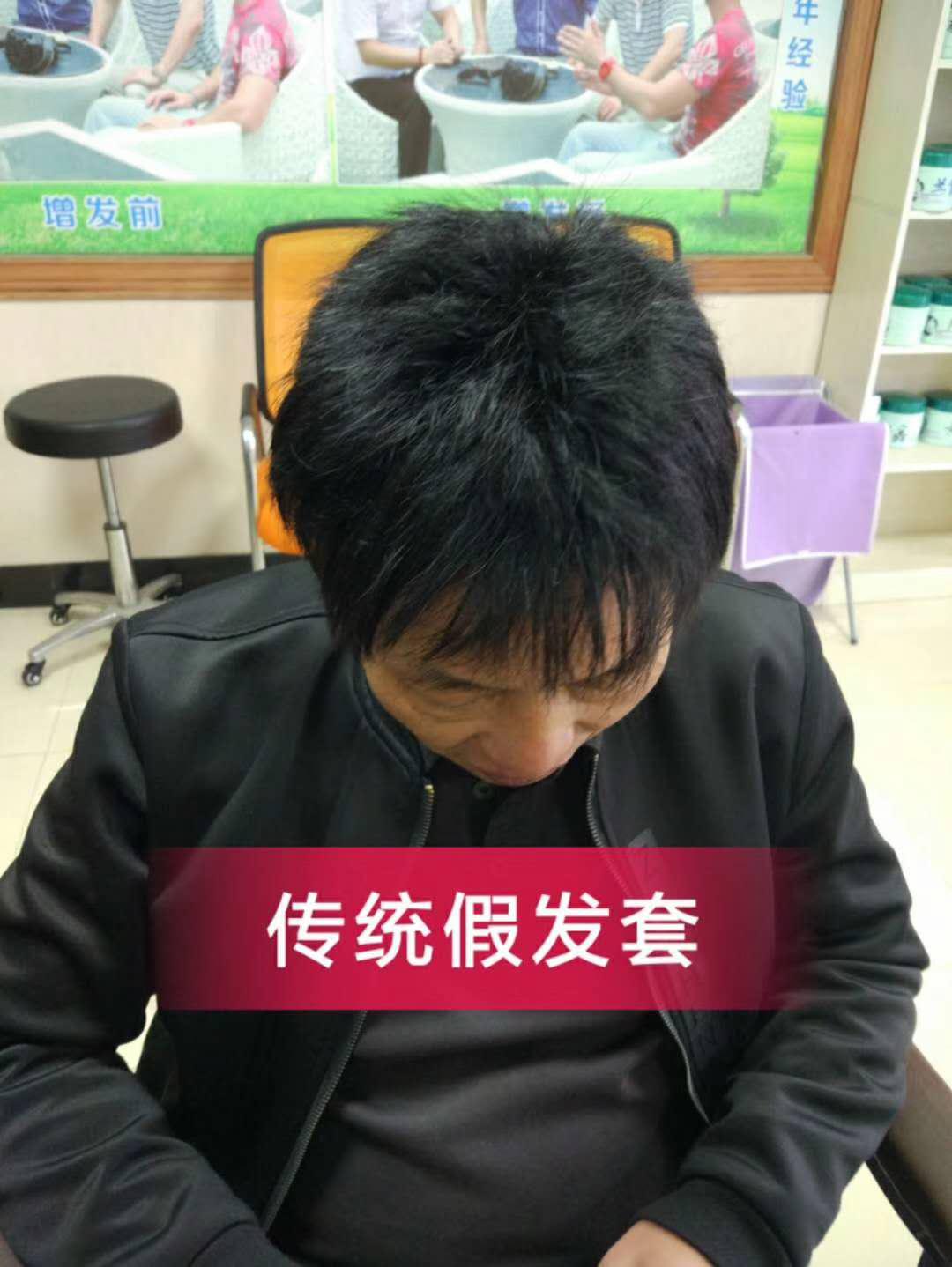 脫發(fā)謝頂壓力大，增發(fā)補(bǔ)發(fā)一身輕！