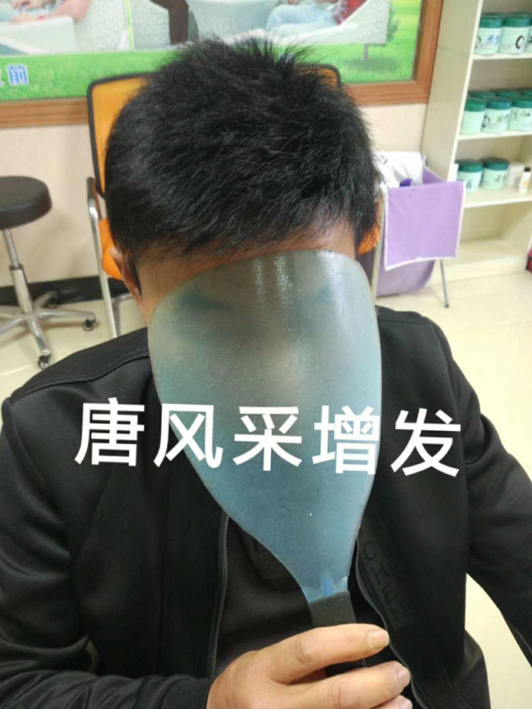 脫發(fā)謝頂壓力大，增發(fā)補(bǔ)發(fā)一身輕！