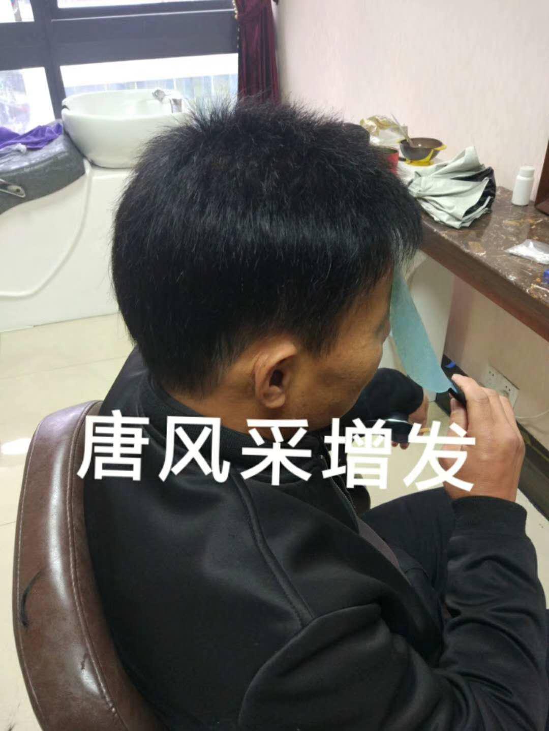 脫發(fā)謝頂壓力大，增發(fā)補(bǔ)發(fā)一身輕！