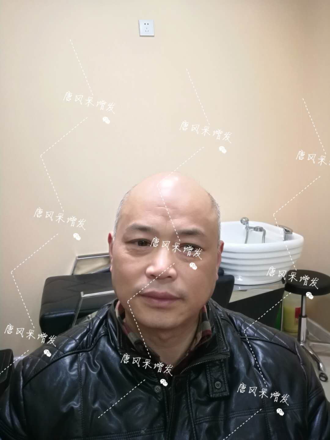 我的天吶！沒想到某防脫洗發(fā)水的老板居然也脫發(fā)了！