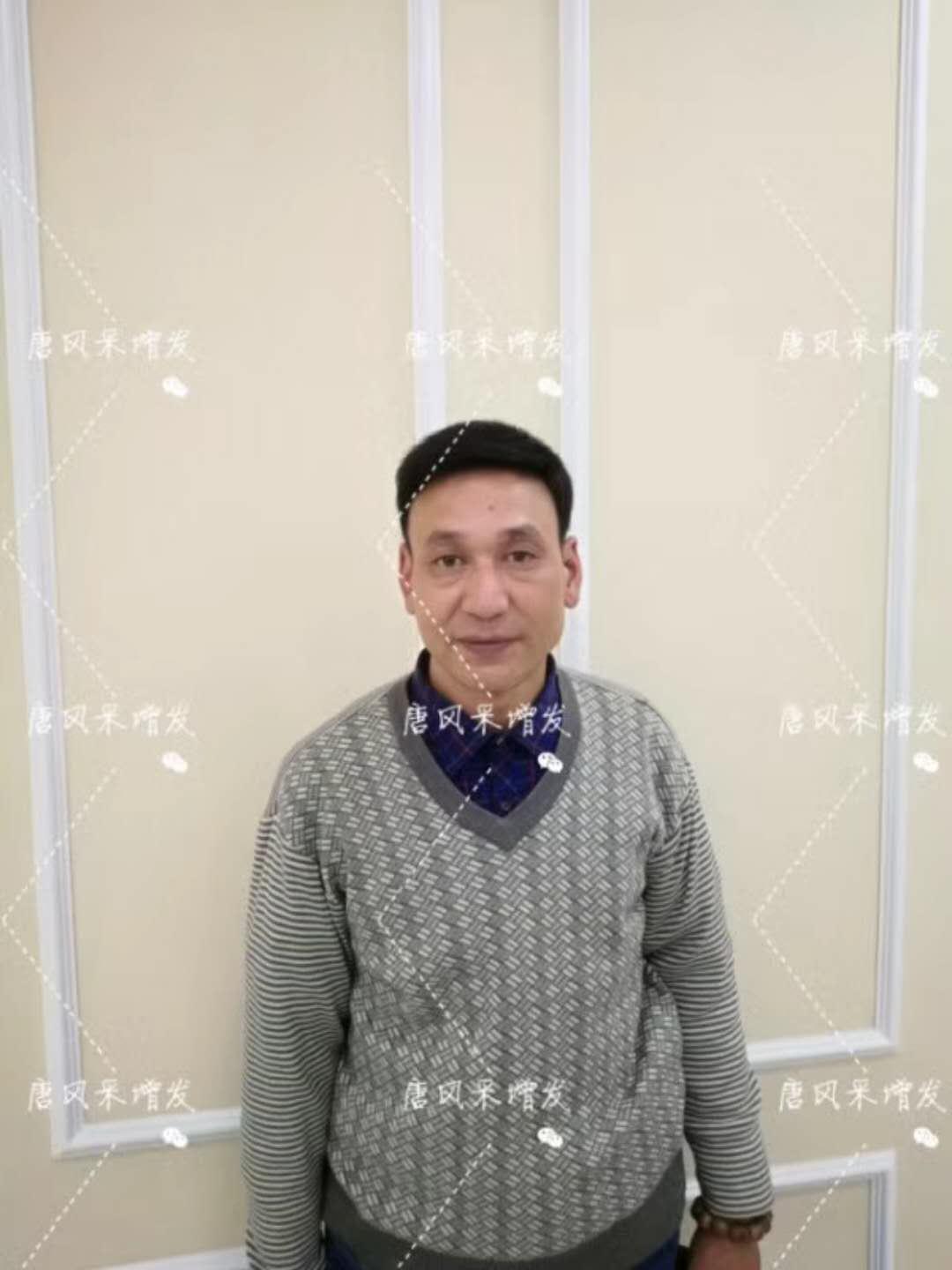 我的天吶！沒想到某防脫洗發(fā)水的老板居然也脫發(fā)了！