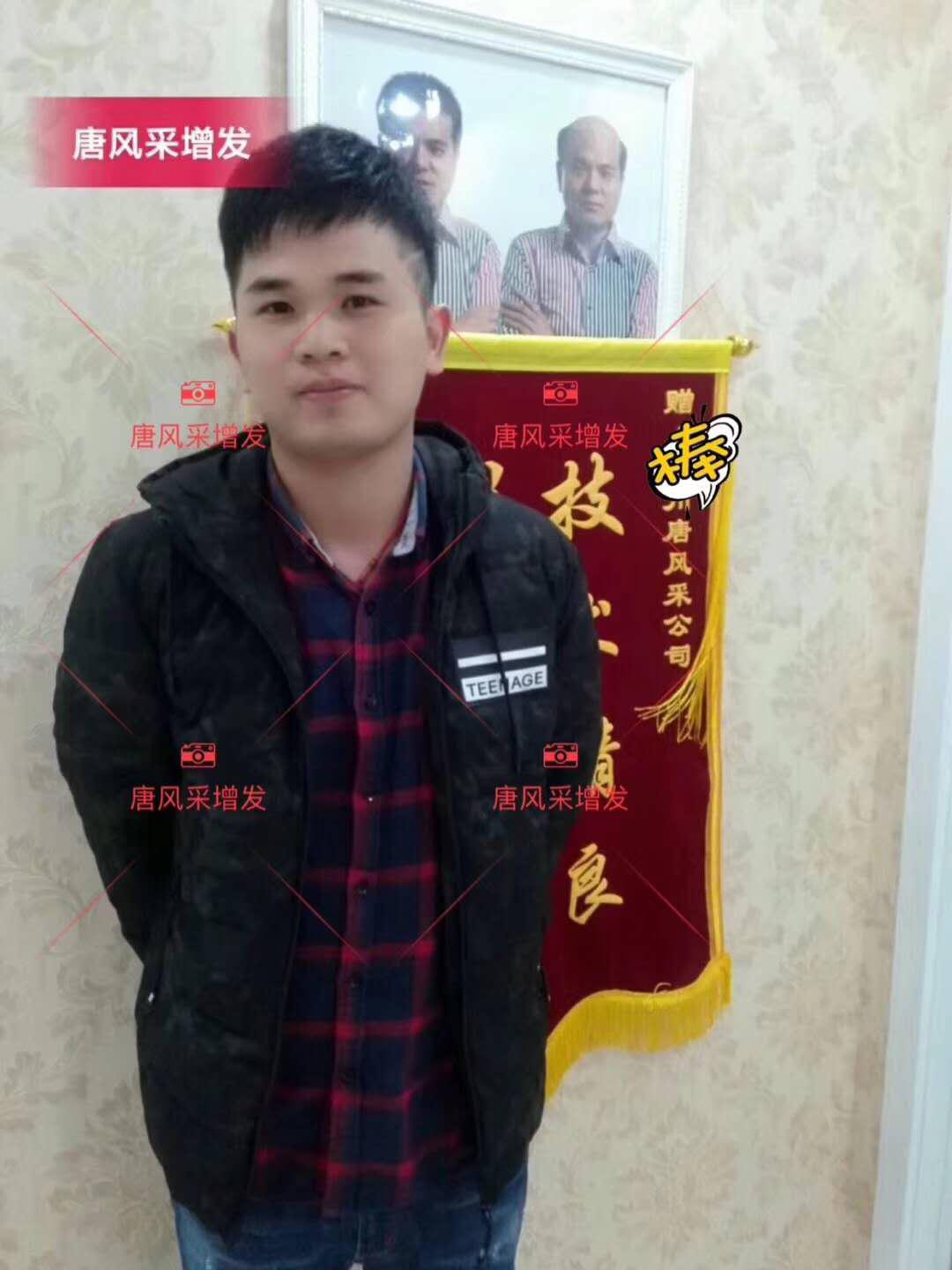 為脫發(fā)者解千愁，增發(fā)前后的驚人對(duì)比！