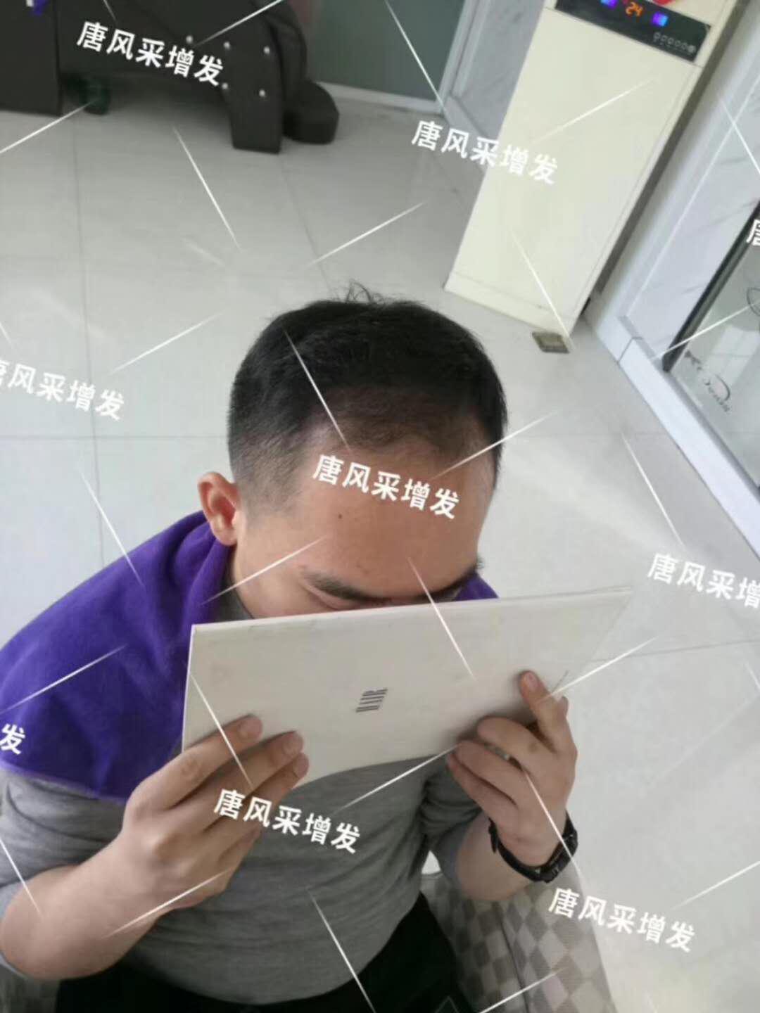 感覺自尊心好受打擊，朋友說我“頭上的油都夠炒盤菜了...