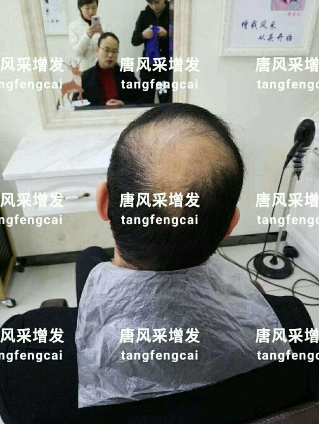  一轉(zhuǎn)眼年輕十歲，你差的就是這點(diǎn)點(diǎn)頭發(fā)！