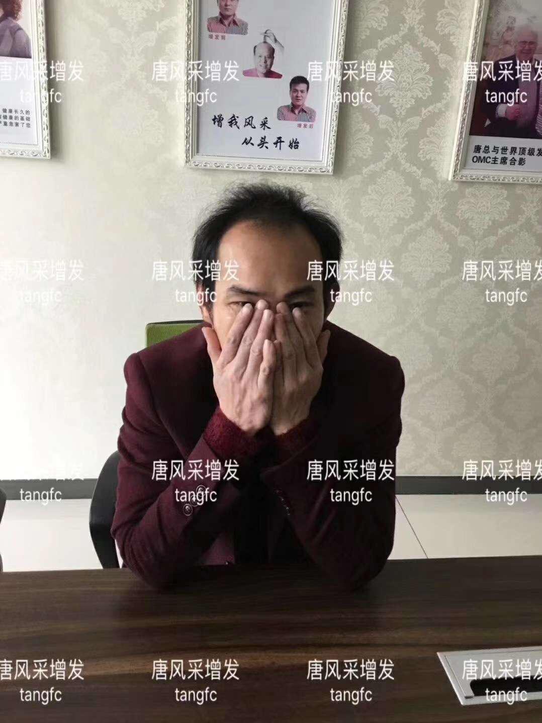 一轉(zhuǎn)眼年輕十歲，你差的就是這點(diǎn)點(diǎn)頭發(fā)！