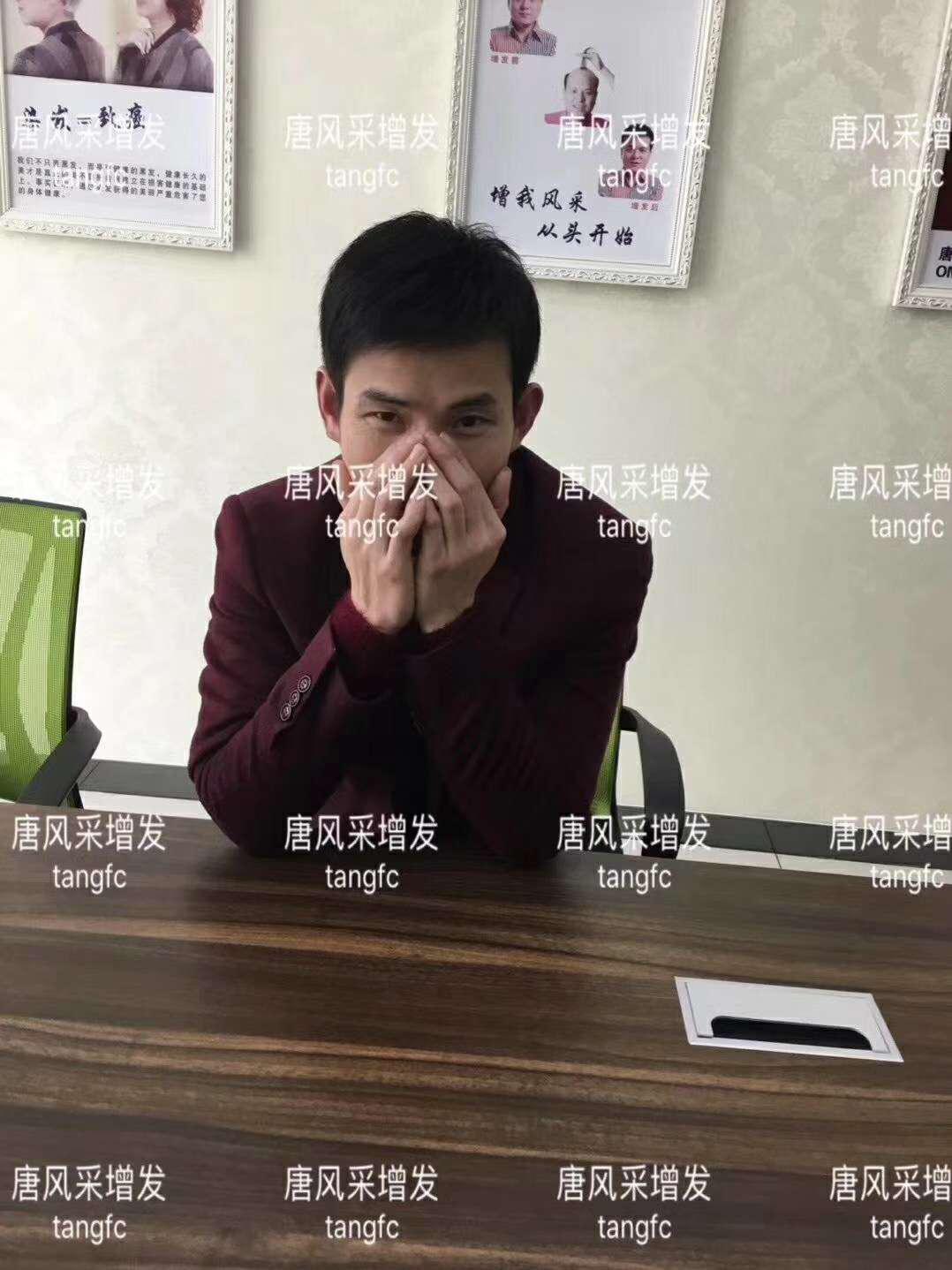  一轉(zhuǎn)眼年輕十歲，你差的就是這點(diǎn)點(diǎn)頭發(fā)！