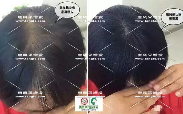女士假發(fā)見證華麗轉(zhuǎn)變，前后差別震撼！