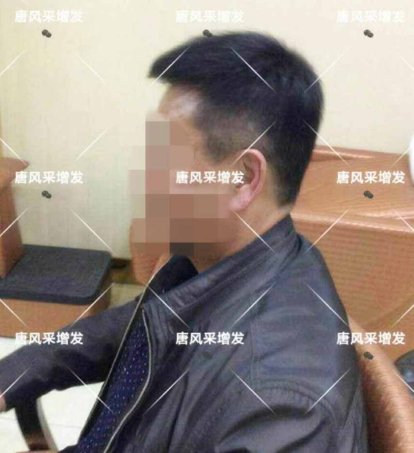 男人脫發(fā)原因多，不能一味怨腎虧！