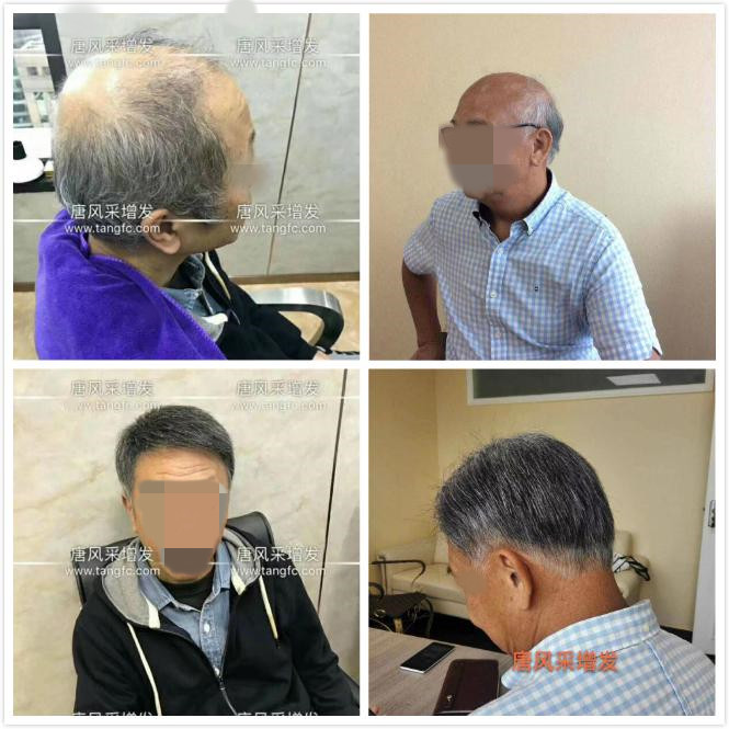 男老人假發(fā)超薄設(shè)計，這樣的逼真效果你絕對沒見過！