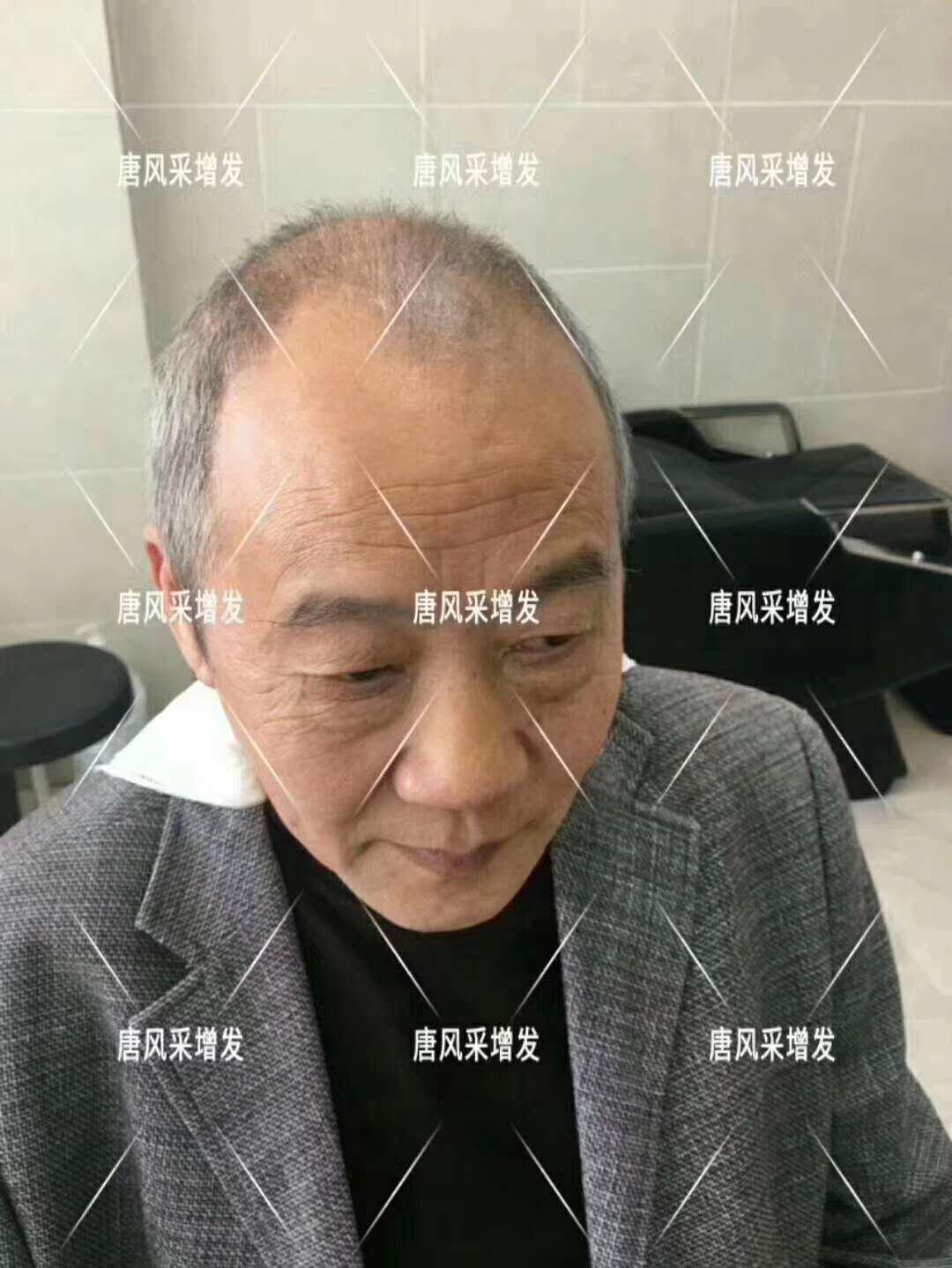 常按這個(gè)穴位好處多多 有助睡眠還能減少白頭發(fā)！