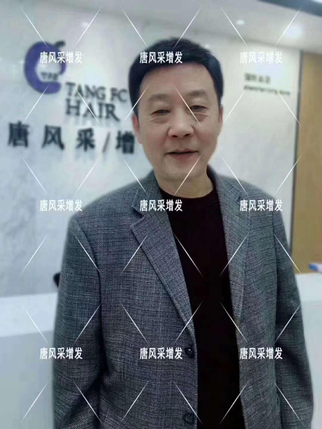 常按這個(gè)穴位好處多多 有助睡眠還能減少白頭發(fā)！
