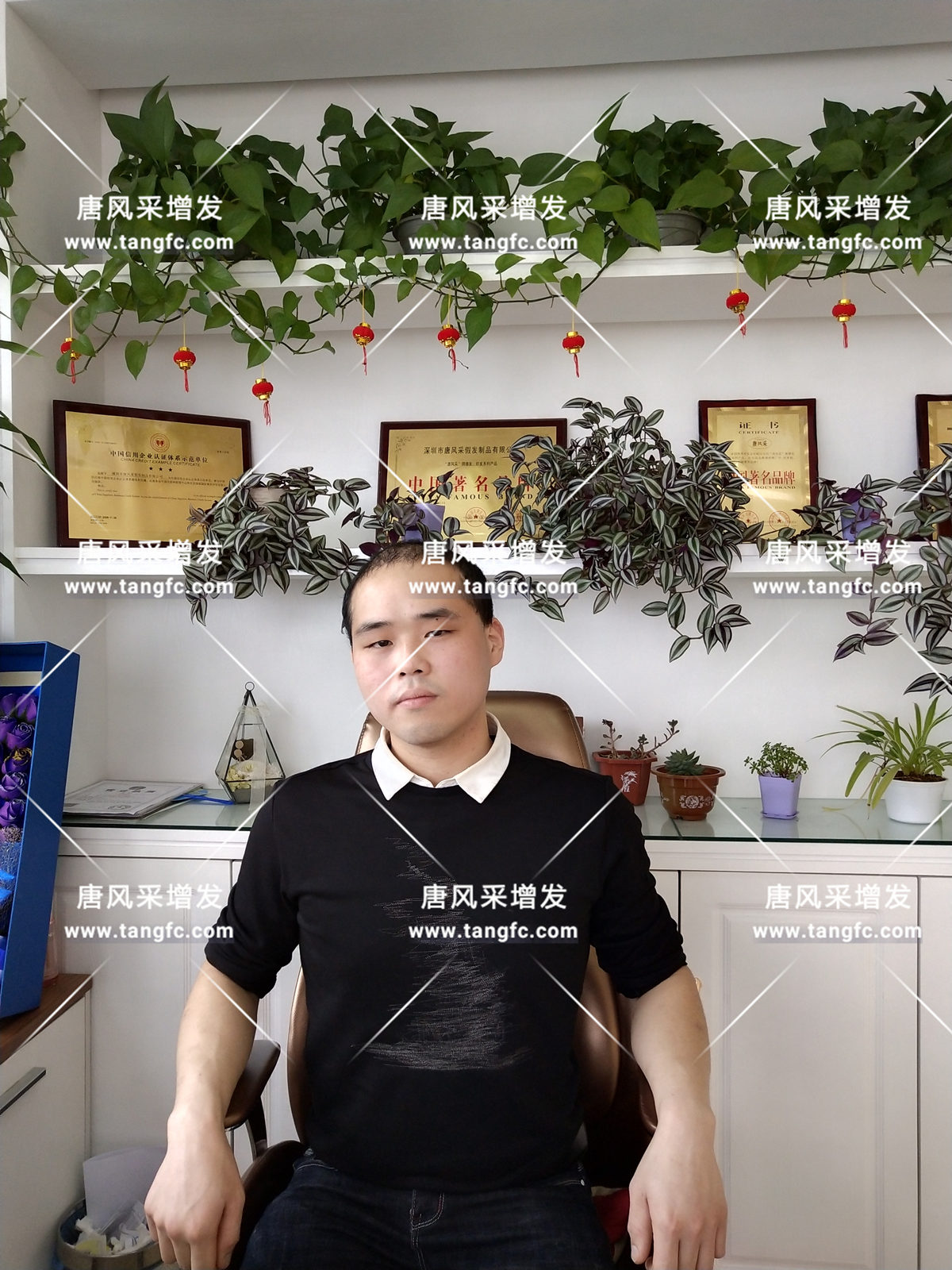 增發(fā)還是植發(fā)，這是個問題！