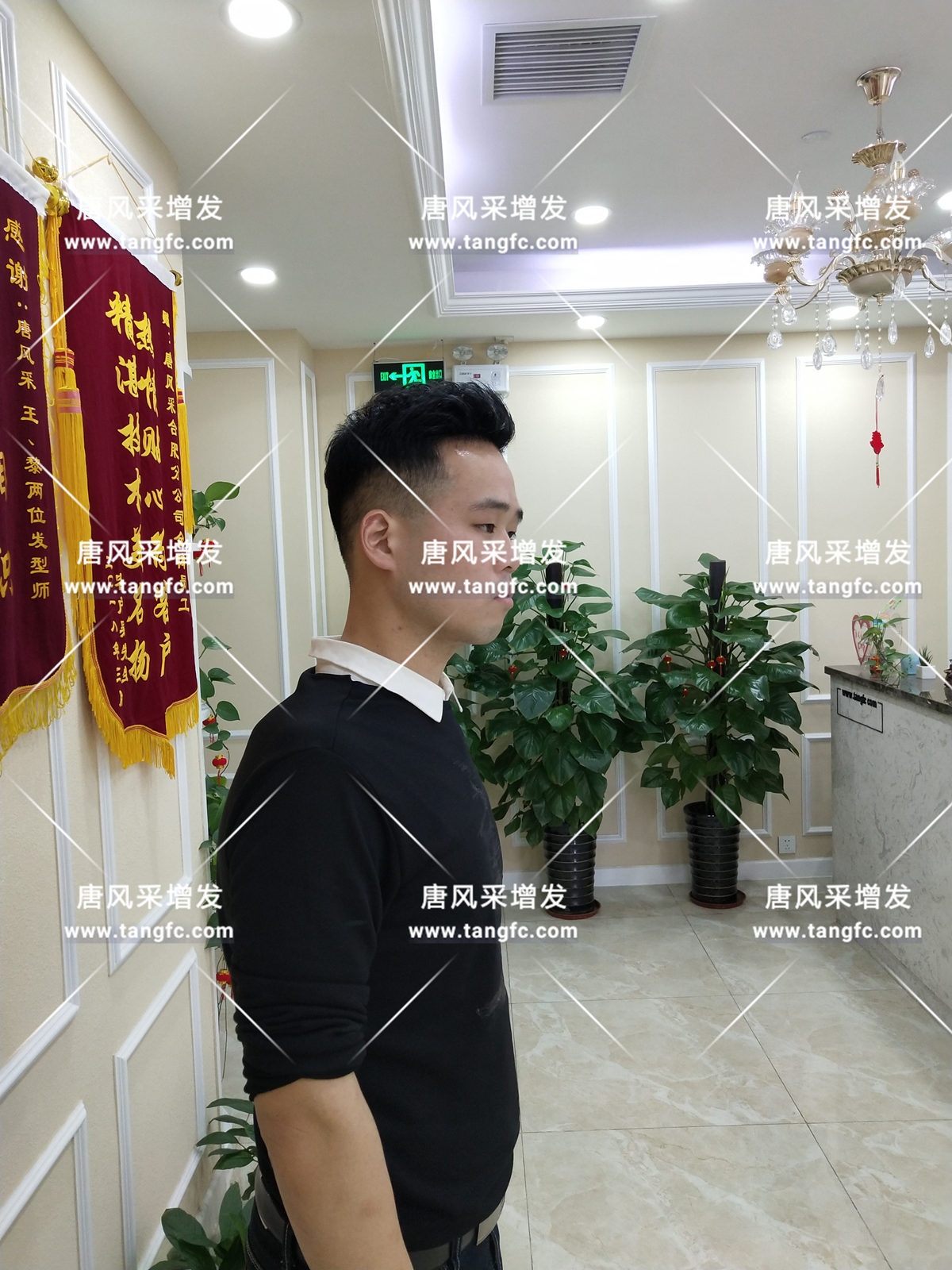 增發(fā)還是植發(fā)，這是個問題！