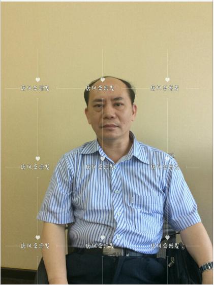存款重要還是頭發(fā)重要？聽聽李先生怎么說！