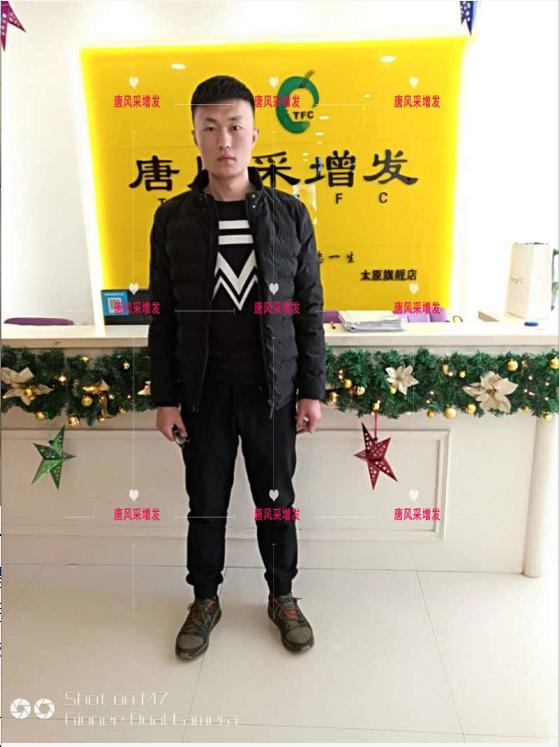 好形象擁抱新生活，唐風采助力脫發(fā)新青年！