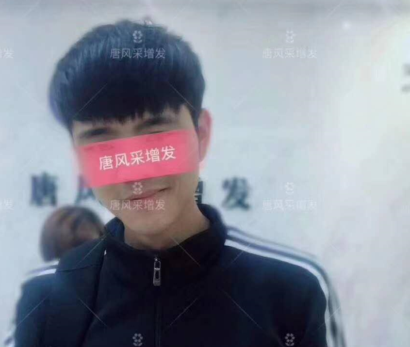 春夏季最新帥氣發(fā)型，頭發(fā)再少也能hold??！