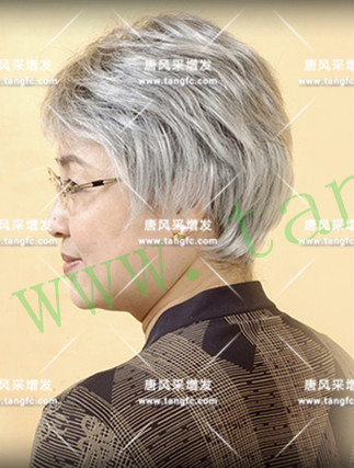 嘉興專業(yè)織發(fā)補(bǔ)發(fā)幫助發(fā)友回歸正常生活，笑對(duì)磨難