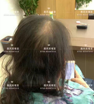 讓頭發(fā)一直好好的，唐風(fēng)采就是這般任性！