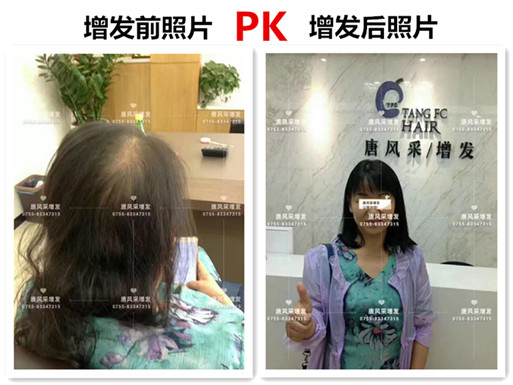 頭發(fā)稀少也能擁有一頭好發(fā)型，不信請(qǐng)看！