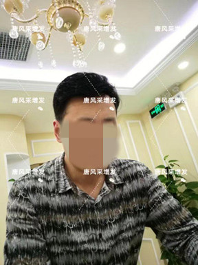 嘉興買隱形假發(fā)哪家好？很多人選擇嗎？