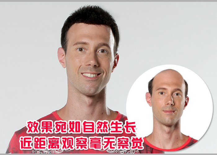 男士假發(fā)套價格貴嗎？買多少錢的效果看起來才逼真？