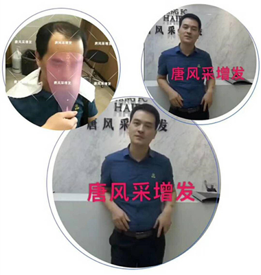 光禿禿的院子光禿禿的頭，與其羨慕不如改變！