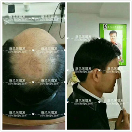 男款假發(fā)品牌哪家好，有用過唐風(fēng)采的嗎？