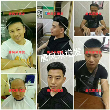男款假發(fā)品牌哪家好，有用過唐風(fēng)采的嗎？
