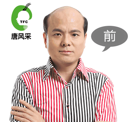 西寧補(bǔ)發(fā)哪里好誰知道？ 90后脫發(fā)了想做補(bǔ)發(fā)！