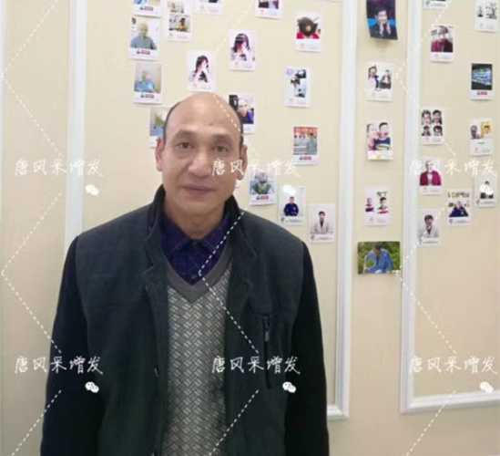 《我不是藥神》火了，山爭(zhēng)哥哥光頭變“藥神”成熱門(mén)話(huà)題！
