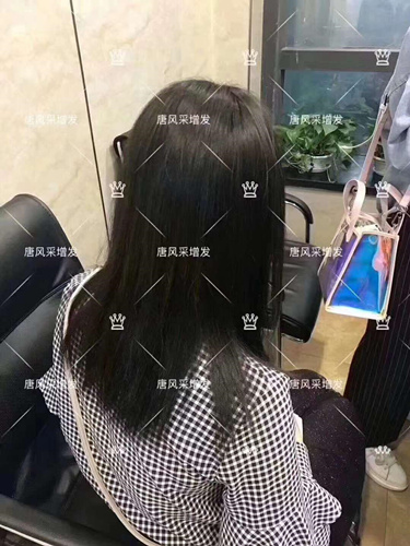 西寧織發(fā)補(bǔ)發(fā)需要多少錢,哪家補(bǔ)發(fā)技術(shù)好？