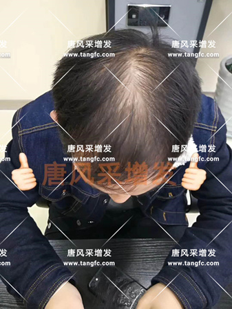臺(tái)州哪里有賣假發(fā)的，逼真效果怎么樣？