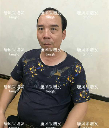 朋友碰面不敢認，直擊發(fā)友增發(fā)后的真實改變！