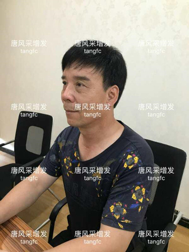 朋友碰面不敢認，直擊發(fā)友增發(fā)后的真實改變！