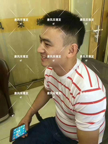 西寧織發(fā)補發(fā)哪家好，真的能改變我的脫發(fā)形象嗎？ 