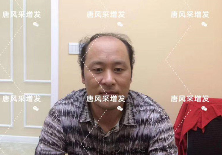 嘉興假發(fā)片定制哪家好？唐風采增發(fā)成了首選！