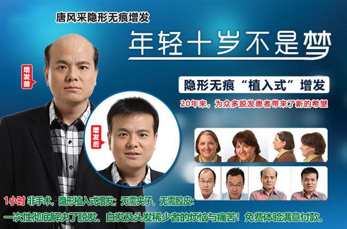 嘉興假發(fā)片定制哪家好？唐風采增發(fā)成了首選！