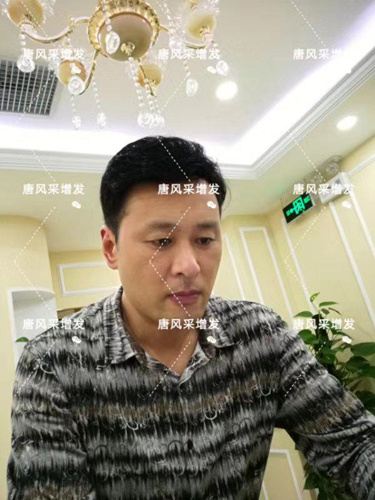 嘉興假發(fā)片定制哪家好？唐風采增發(fā)成了首選！