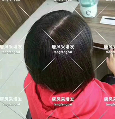 唐風(fēng)采增發(fā)客戶(hù)案例