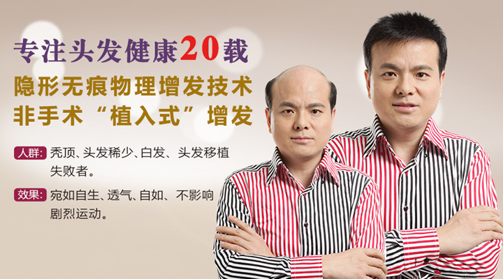 白發(fā)變黑方法介紹 唐風(fēng)采增發(fā)